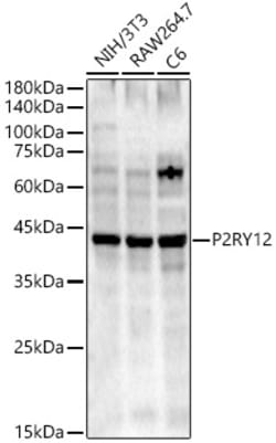 Invitrogen P2Y12 Polyclonal Antibody 100 &mu;L | Buy Online | Invitrogen&trade; | Fisher Scientific