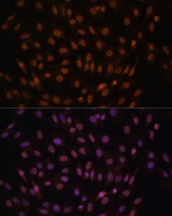 Invitrogen FCF1 Polyclonal Antibody 100 &mu;L; Unconjugated:Antibodies,