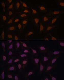 Invitrogen FCF1 Polyclonal Antibody 100 &mu;L; Unconjugated:Antibodies,