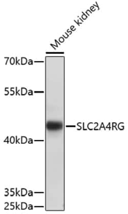 Invitrogen SLC2A4RG Polyclonal Antibody 100 &mu;L; Unconjugated:Antibodies,
