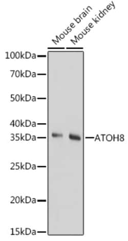 Invitrogen ATOH8 Polyclonal Antibody 100 &mu;L; Unconjugated:Antibodies,