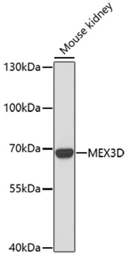 Invitrogen RKHD1 Polyclonal Antibody 100 &mu;L; Unconjugated:Antibodies,