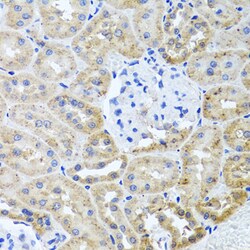 Invitrogen HDAC6 Polyclonal Antibody 100 &mu;L; Unconjugated:Antibodies,