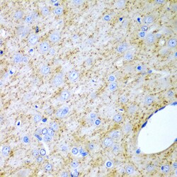 Invitrogen INHA Polyclonal Antibody 100 &mu;L | Buy Online | Invitrogen&trade; | Fisher Scientific