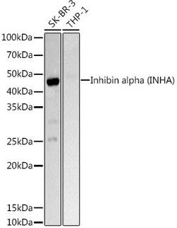Invitrogen INHA Polyclonal Antibody 100 &mu;L | Buy Online | Invitrogen&trade; | Fisher Scientific