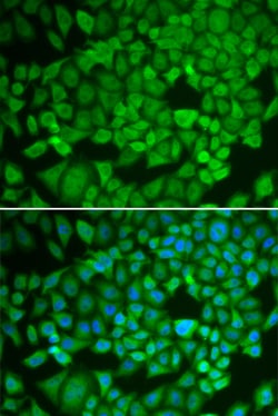 Invitrogen NR0B1 Polyclonal Antibody 100 &mu;L; Unconjugated:Antibodies,
