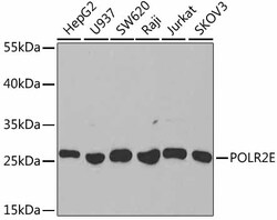 Invitrogen POLR2E Polyclonal Antibody 100 &mu;L | Buy Online | Invitrogen&trade; | Fisher Scientific