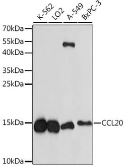 Invitrogen CCL20 Polyclonal Antibody 100 &mu;L; Unconjugated:Antibodies,
