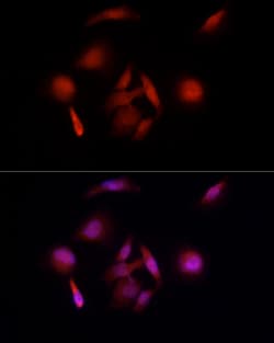 Invitrogen E6AP Polyclonal Antibody 100 &mu;L; Unconjugated:Antibodies,