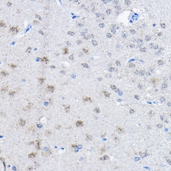 Invitrogen E6AP Polyclonal Antibody 100 &mu;L; Unconjugated:Antibodies,