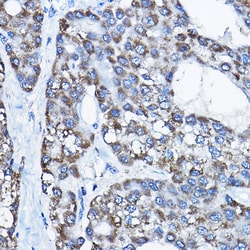 Invitrogen E6AP Polyclonal Antibody 100 &mu;L; Unconjugated:Antibodies,