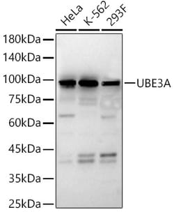Invitrogen E6AP Polyclonal Antibody 100 &mu;L; Unconjugated:Antibodies,