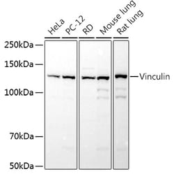 Invitrogen Vinculin Polyclonal Antibody 100 &mu;L; Unconjugated:Antibodies,