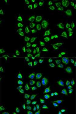 Invitrogen CD1d Polyclonal Antibody 100 &mu;L; Unconjugated:Antibodies,