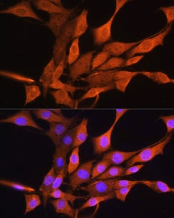 AIRE Polyclonal Antibody:Antibodies, Polyclonal