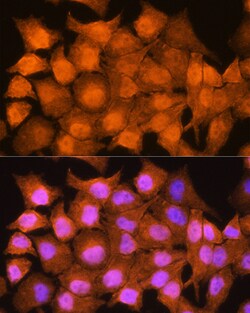 AIRE Polyclonal Antibody:Antibodies, Polyclonal
