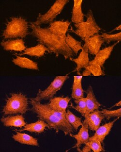 AIRE Polyclonal Antibody:Antibodies, Polyclonal