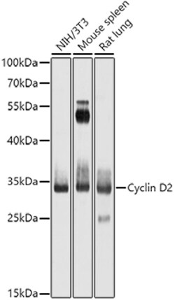 Invitrogen Cyclin D2 Polyclonal Antibody 100 &mu;L; Unconjugated:Antibodies,