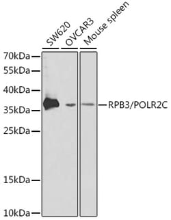 Invitrogen POLR2C Polyclonal Antibody 100 &mu;L; Unconjugated:Antibodies,