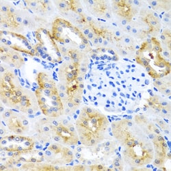 Invitrogen MOK Polyclonal Antibody 100 &mu;L; Unconjugated:Antibodies,
