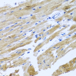 Invitrogen MOK Polyclonal Antibody 100 &mu;L; Unconjugated:Antibodies,