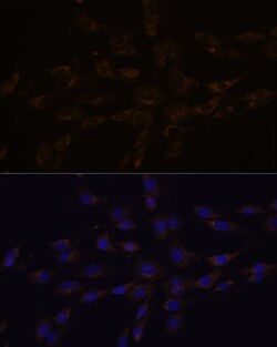 Invitrogen RGS4 Polyclonal Antibody 100 &mu;L; Unconjugated:Antibodies,