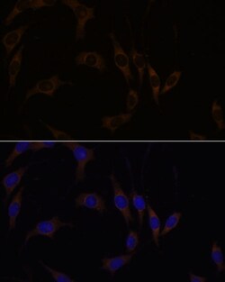 Invitrogen RGS4 Polyclonal Antibody 100 &mu;L; Unconjugated:Antibodies,