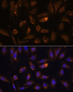 Invitrogen RGS4 Polyclonal Antibody 100 &mu;L; Unconjugated:Antibodies,