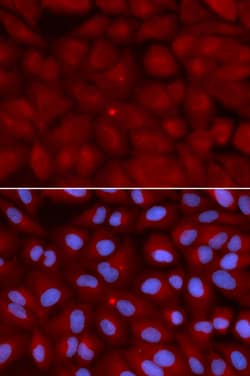 Invitrogen BIN1 Polyclonal Antibody 100 &mu;L; Unconjugated:Antibodies,