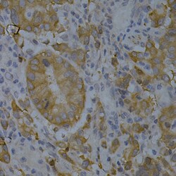 Invitrogen BIN1 Polyclonal Antibody 100 &mu;L; Unconjugated:Antibodies,