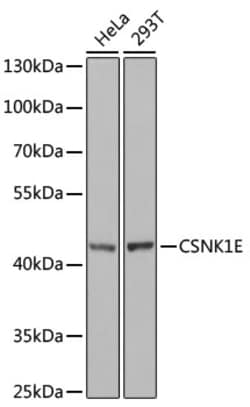 Invitrogen CK1 epsilon Polyclonal Antibody 100 &mu;L; Unconjugated:Antibodies,