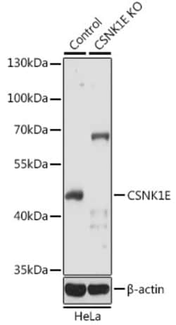 Invitrogen CK1 epsilon Polyclonal Antibody 100 &mu;L; Unconjugated:Antibodies,