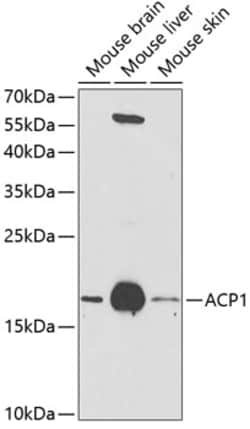 Invitrogen Acid Phosphatase 1 Polyclonal Antibody 100 &mu;L; Unconjugated:Antibodies,