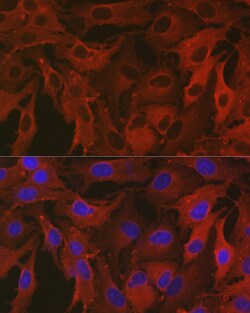 Invitrogen ALDH1A1 Polyclonal Antibody 100 &mu;L; Unconjugated:Antibodies,