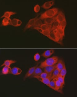 Invitrogen ALDH1A1 Polyclonal Antibody 100 &mu;L; Unconjugated:Antibodies,