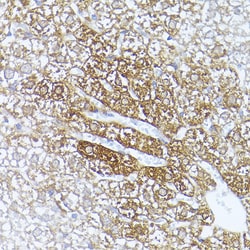 Invitrogen ALDH1A1 Polyclonal Antibody 100 &mu;L; Unconjugated:Antibodies,