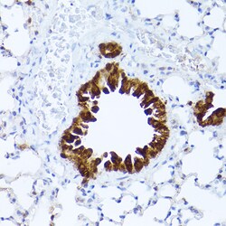 Invitrogen ALDH1A1 Polyclonal Antibody 100 &mu;L; Unconjugated:Antibodies,
