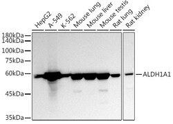 Invitrogen ALDH1A1 Polyclonal Antibody 100 &mu;L; Unconjugated:Antibodies,