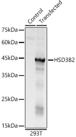 Invitrogen HSD3B2 Polyclonal Antibody 100 &mu;L; Unconjugated:Antibodies,