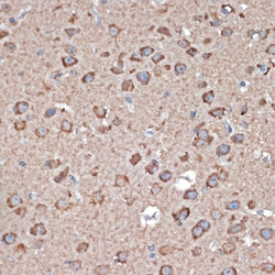 Invitrogen GluR1 Polyclonal Antibody 100 &mu;L; Unconjugated:Antibodies,