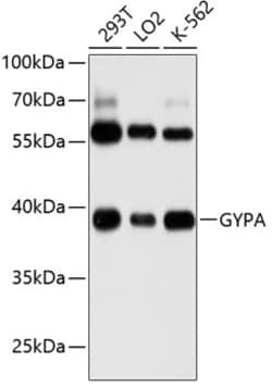 Invitrogen CD235a Polyclonal Antibody 100 &mu;L; Unconjugated:Antibodies,
