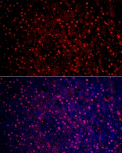 Invitrogen Arginase 1 Polyclonal Antibody 100 &mu;L; Unconjugated:Antibodies,