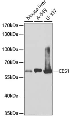 Invitrogen CES1 Polyclonal Antibody 100 &mu;L; Unconjugated:Antibodies,