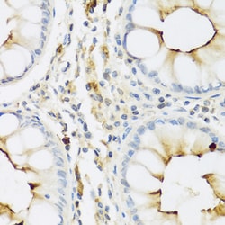 Invitrogen RNASE3 Polyclonal Antibody 100 &mu;L; Unconjugated:Antibodies,