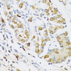 Invitrogen RNASE3 Polyclonal Antibody 100 &mu;L; Unconjugated:Antibodies,
