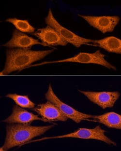 Invitrogen Iduronate 2 Sulfatase Polyclonal Antibody 100 &mu;L; Unconjugated:Antibodies,