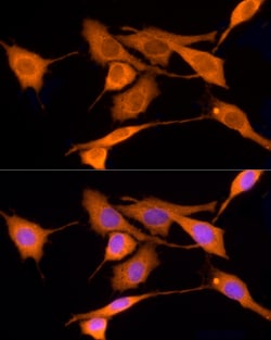 Invitrogen Iduronate 2 Sulfatase Polyclonal Antibody 100 &mu;L; Unconjugated:Antibodies,