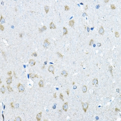 Invitrogen Iduronate 2 Sulfatase Polyclonal Antibody 100 &mu;L; Unconjugated:Antibodies,