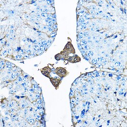 Invitrogen Iduronate 2 Sulfatase Polyclonal Antibody 100 &mu;L; Unconjugated:Antibodies,