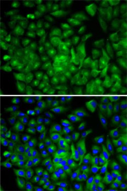Invitrogen ATG16L1 Polyclonal Antibody 100 &mu;L; Unconjugated:Antibodies,